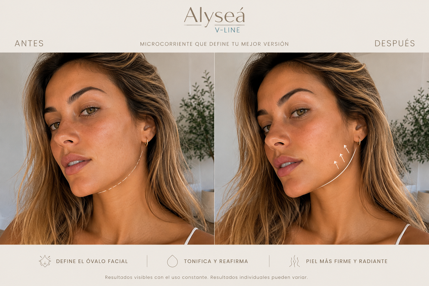 Ilustración conceptual del efecto esperado de Alyseá V-Line — Dispositivo de Microcorriente para Papada y Cuello